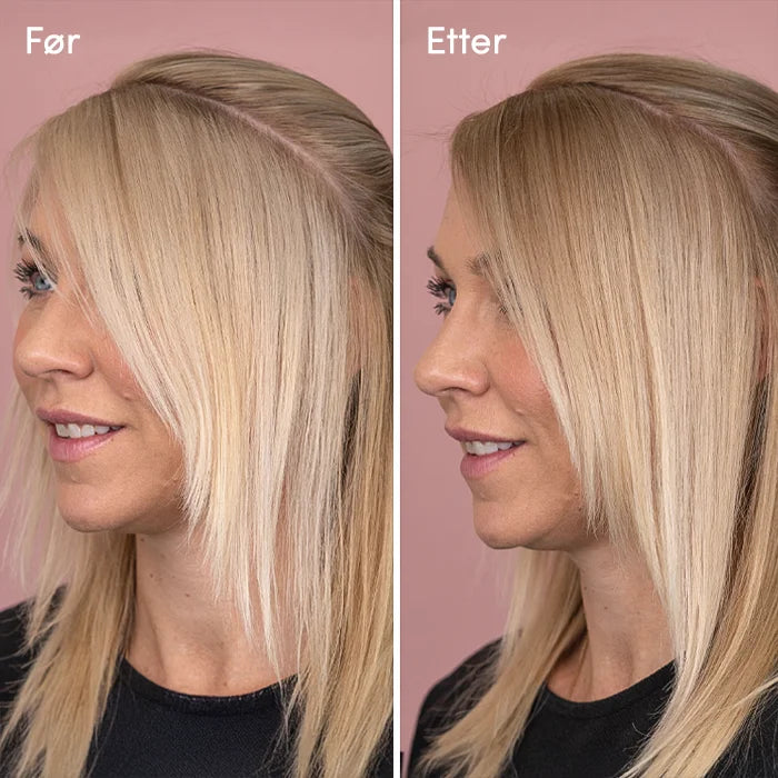 Toning Nr 10 - Dempet & Dybde