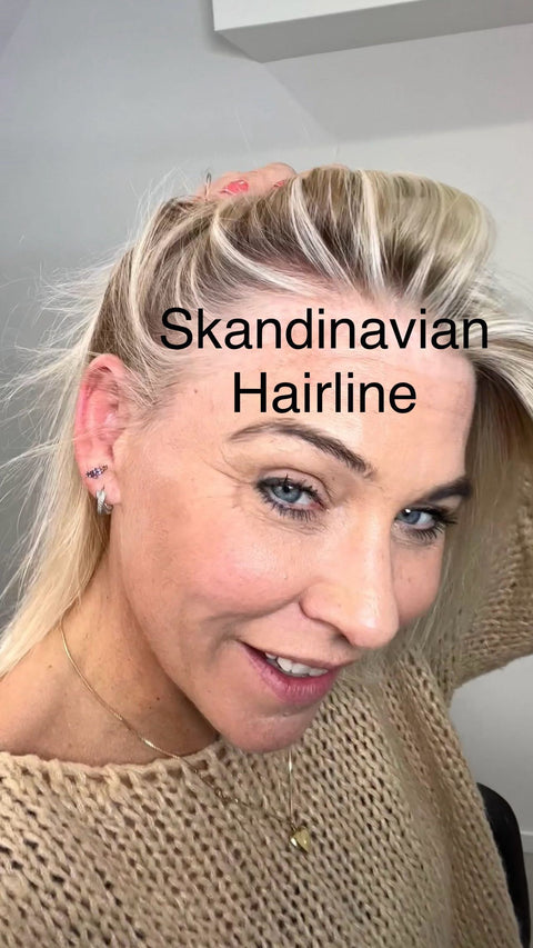 Bleking rundt hårfestet